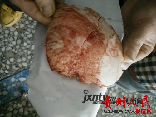 李芬荣从冰箱拿出丈夫的头骨